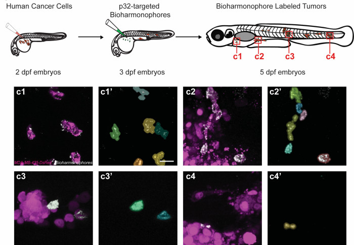 Purple cancer cells are labelled using bioharmonophores