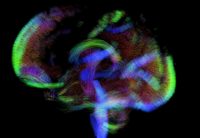 Colourful image shows brain development at 33 weeks