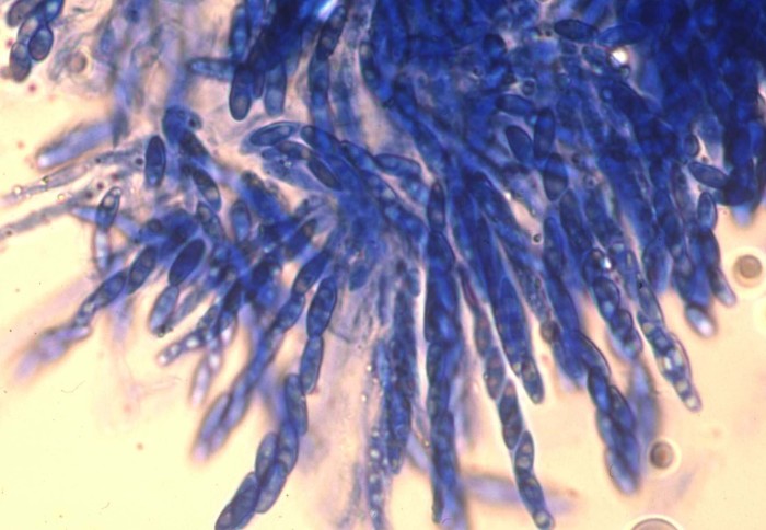 Microscope view of fungal spores