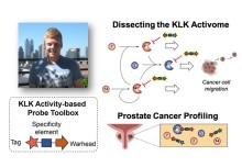 Activity-based probes to dissect the KLK activome in prostate cancer 