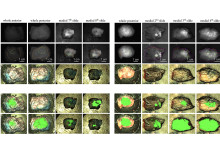 A novel study on Tumour Identification During Fluorescence Guided Breast Surgery