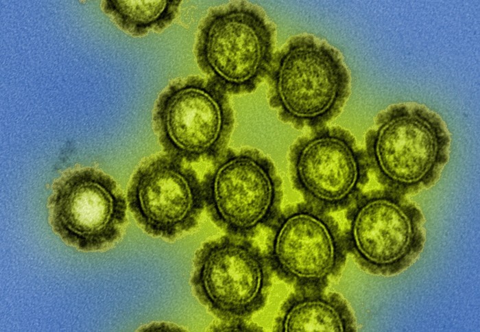 H1N1 influenza virus