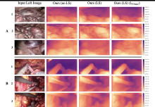 Randomly Connected Neural Network for Self-Supervised Monocular Depth Estimation