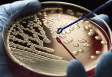Rapid test for antibiotic resistance could help control spread in hospitals
