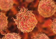 Researchers awarded £1m to trial quicker diagnostic tools for prostate cancer