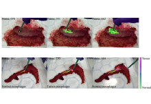 A Real-Time DRS Probe Tracking System for Gastrointestinal Cancer Detection
