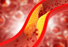 New antibody can unlock secrets of cholesterol