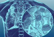 Citizen science shows widespread exposure to drug-resistant fungal spores