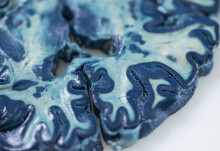 Brain imaging tool falls short for human tissue