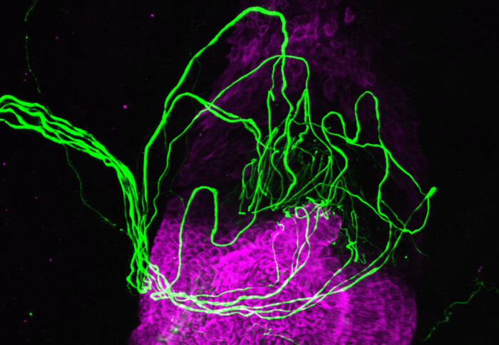 Microscope image of a hair follicle (fluorescent purple) surrounded by string-like sensory nerves (fluorescent green)