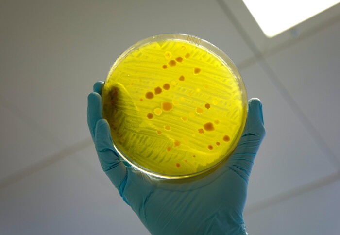 A variety of bacterial species being tested for antimicrobial resistance on a Petri dish.
