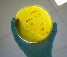 A variety of bacterial species being tested for antimicrobial resistance on a Petri dish.