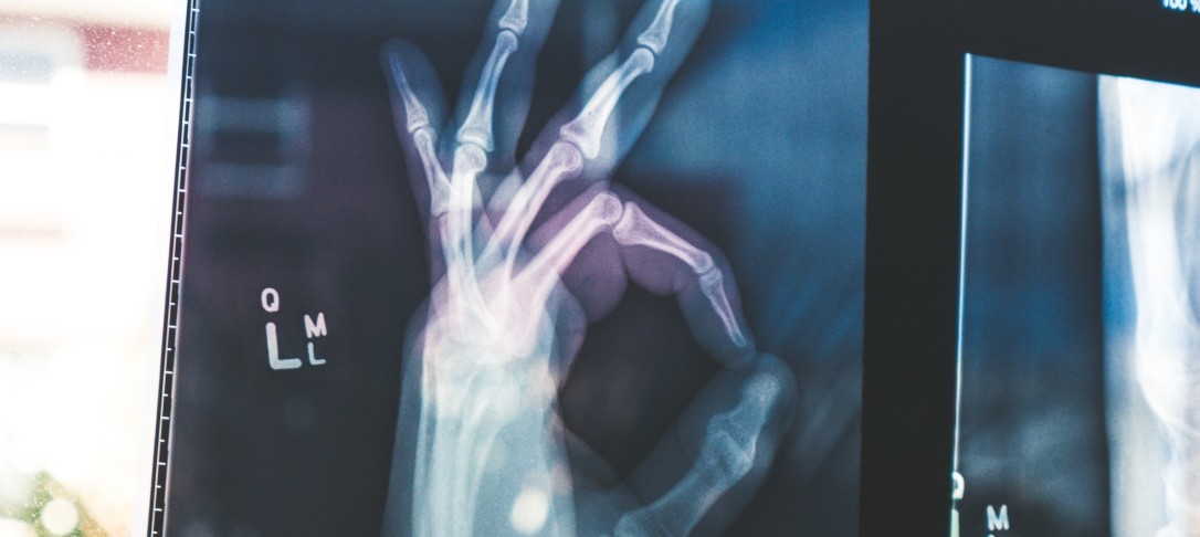 X-ray image of hand