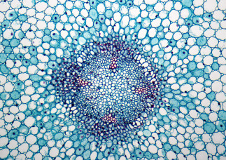 Plant cells under the microscope