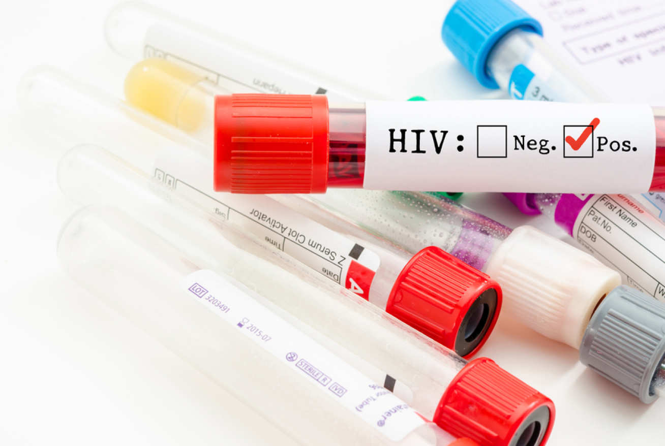 The team warn anti-LGBT laws are hindering HIV testing and treatment