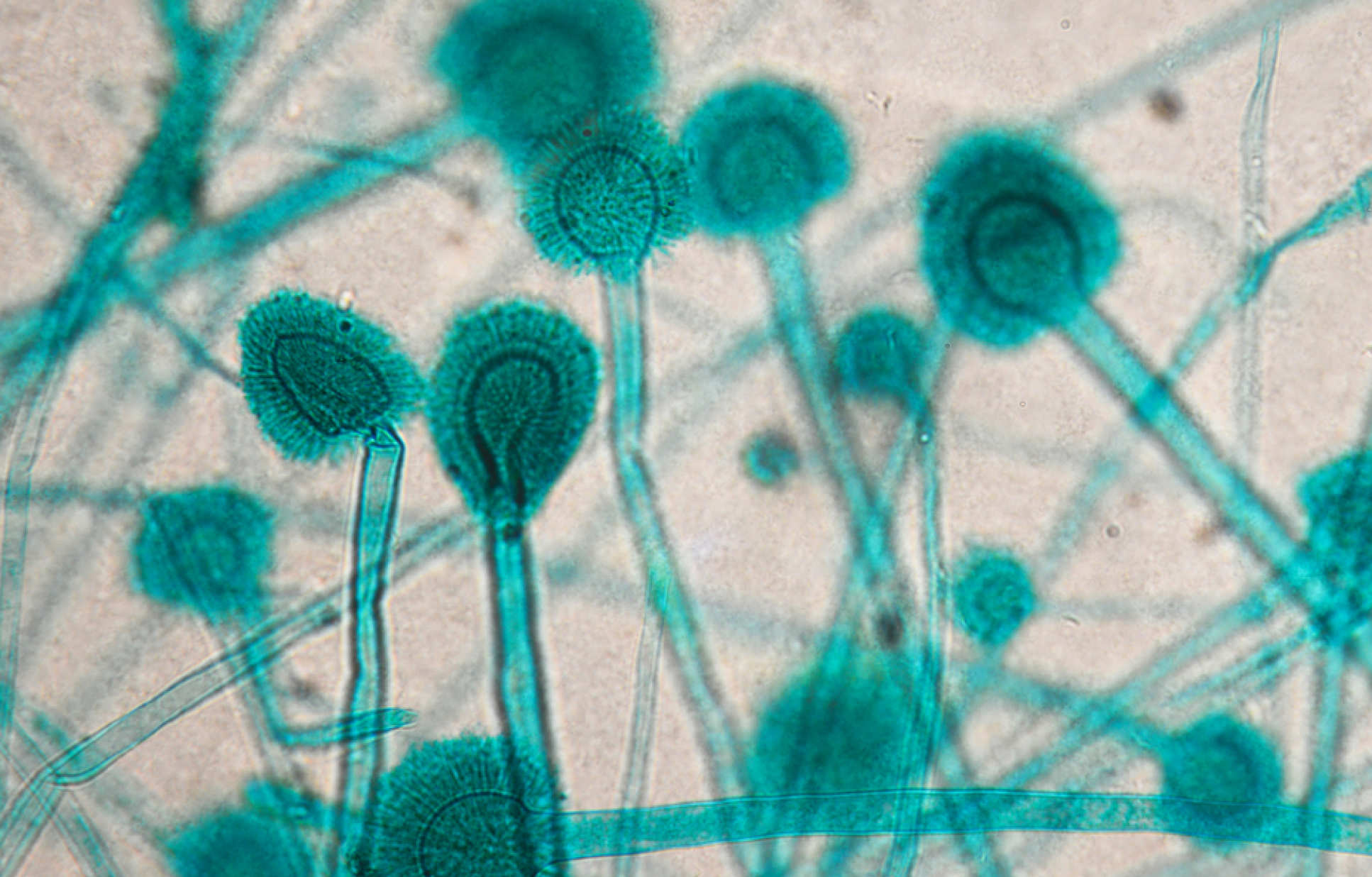 Aspergillus fumigatus thrive on decaying vegetation but are also able to infect those with compromised immune systems, such as cancer patients or those who have received organ transplants