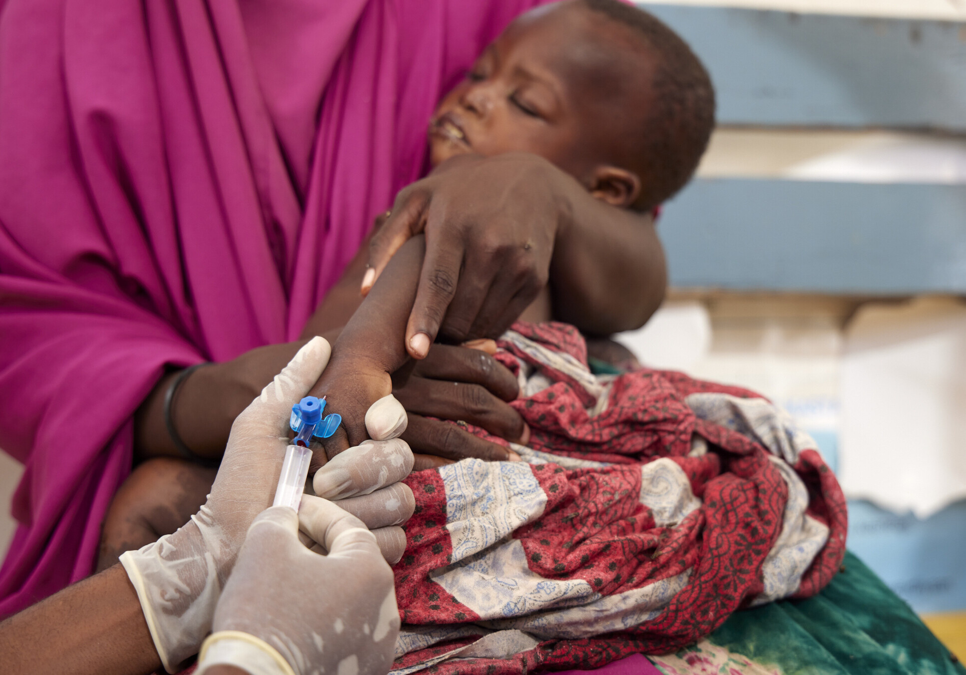 A mother holds a baby that is being treated for malnutrition in Somalia, as a doctor wearing rubber gloves inserts a needle into the baby's hand. 