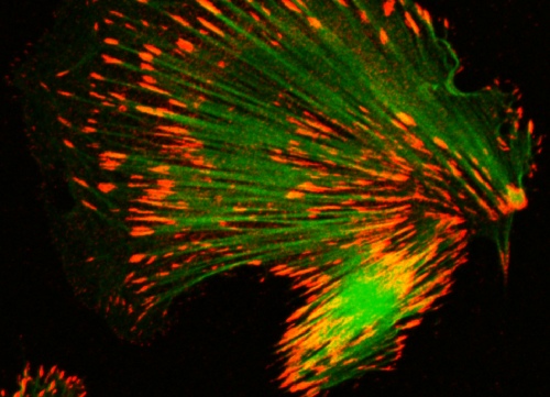   Endothelial cell stained with markers to the adhesion molecule vinculin (red) and the actin cytoskeleton (green)
