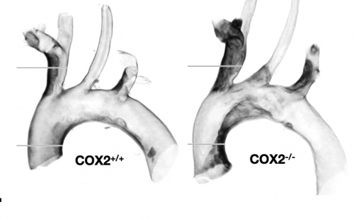 COX-2 deletion increases atherosclerosis