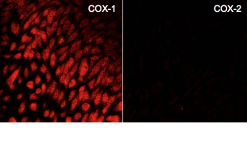COX isoform expression in human aortic endothelial cells