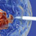 Click to find out more about the Regenerative Medicine and Tissue Engineering research theme