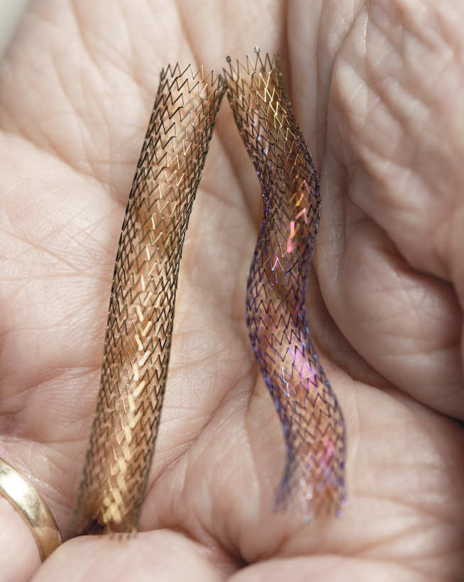 Straight control stent and stent with 3D helical technology held in the palm of a hand.