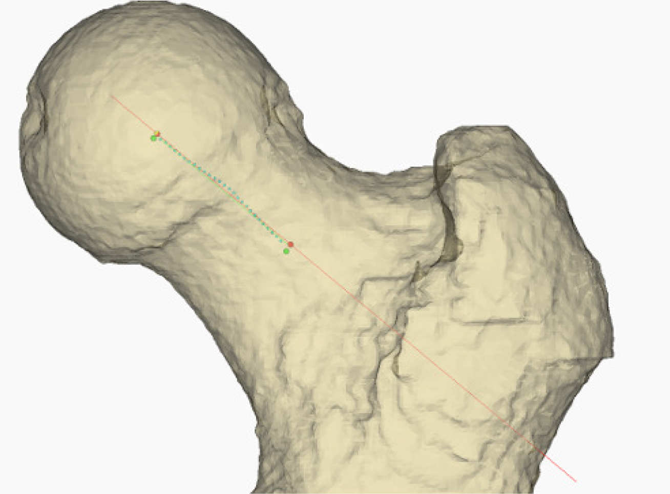 Femoral head model with superimposed axes