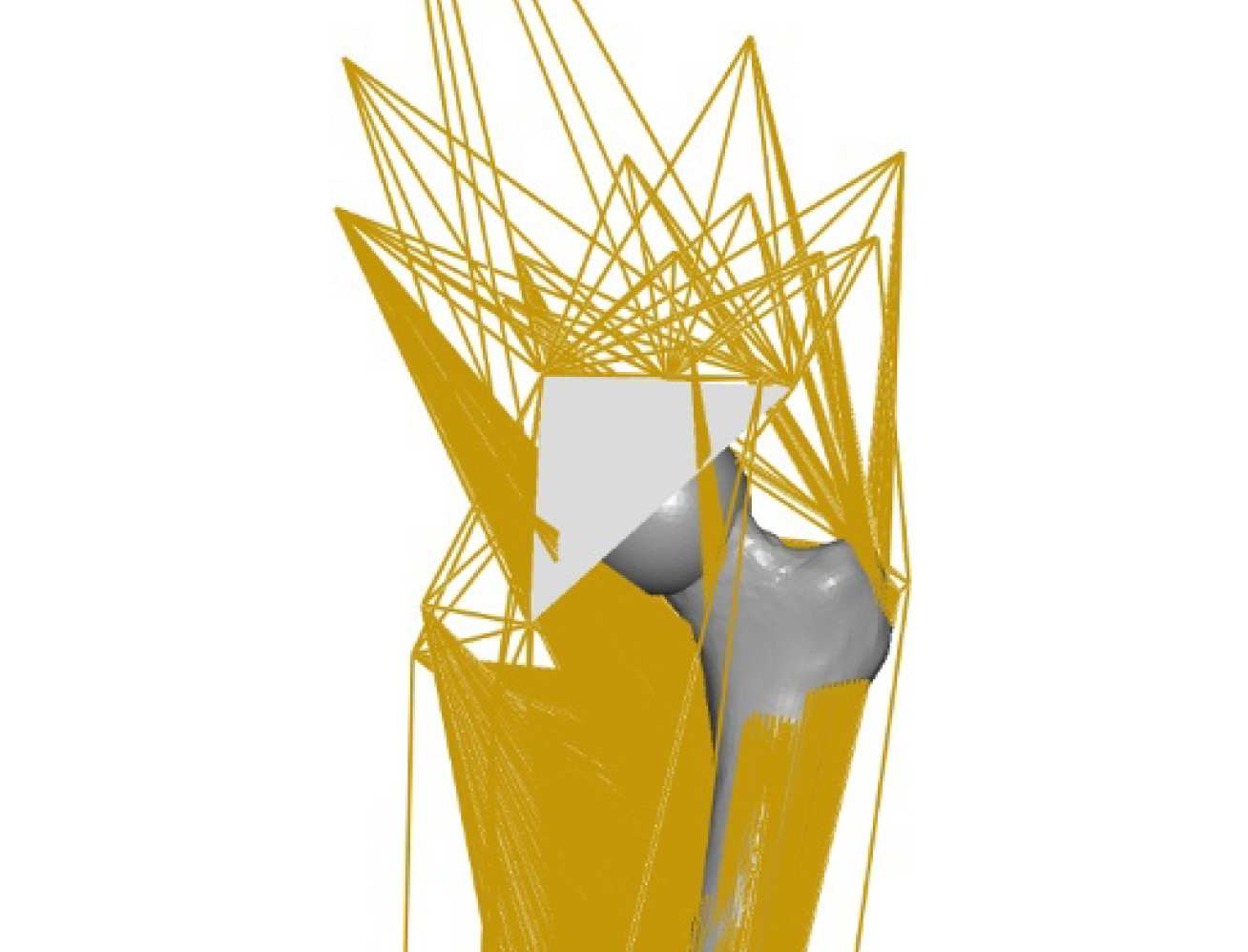   Free boundary condition model of the femur