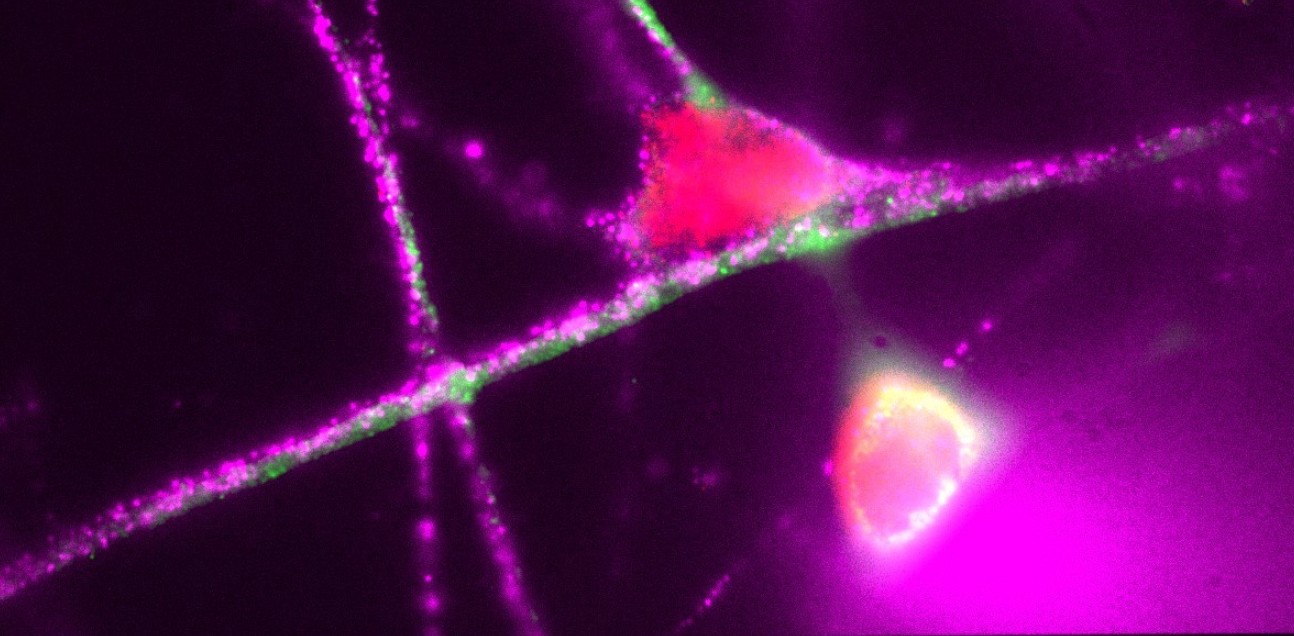 fluroescent image of iPSC derived neuron