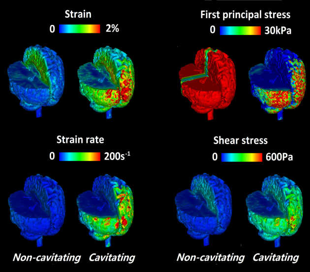 Modelling stresses in the brain in the moments following blast loading