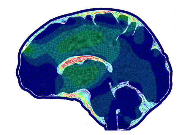 Vascular injury after traumatic brain injury