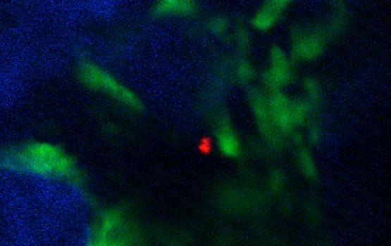 Scientists observe diseased cells using the light microscope (leukaemia cells shown in red)