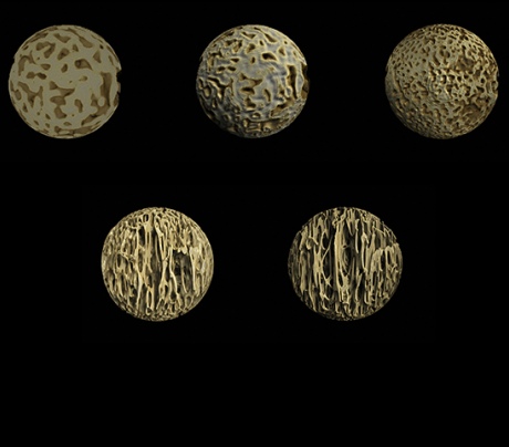 Images of the inner core of bones from the spine across different ages. Top row (from L-R): A foetus at 6 months, at 9 months, and a child between birth and one year. Bottom row (L-R): At just over one year old, and at two and a half years old. 