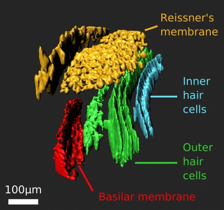Diagram of the inner ear