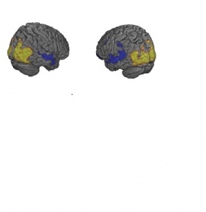 In a previous study, AI designed the best experiment to stimulate the visual cortex (yellow) and deactivate the auditory cortex (blue). This took less than six minutes per brain, compared to over two hours per brain for a human.