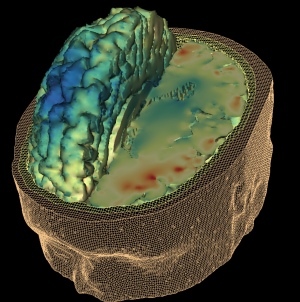 A model of a motorcyclist's brain with TBI (red)