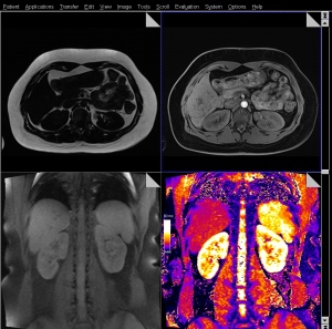 Structural Scans of the kidneys