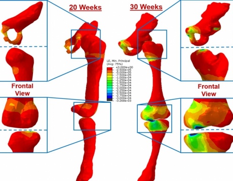 Their data could help shape diagnosis and treatment of conditions which affect skeletal development in the womb