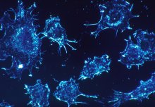 Four ways Imperial is leading the fight against cancer