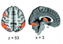 Buzzing the brain with electricity can boost working memory