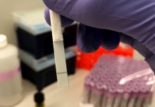 Quick HIV detection method could diagnose early disease