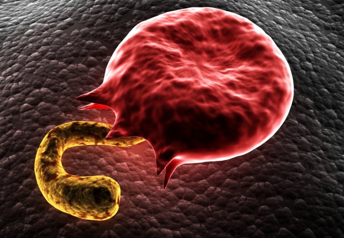 Graphic of  the malaria parasite Plasmodium in a red blood cell