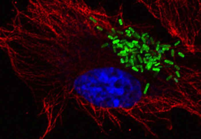 Salmonella bacteria (green) replicating inside an epithelial cell