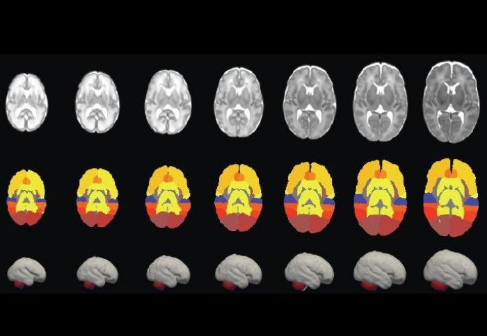 Developing human brain