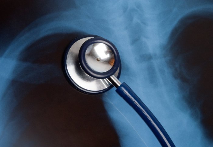 stethoscope and x-ray