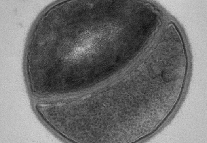 Electron micrograph of MRSA