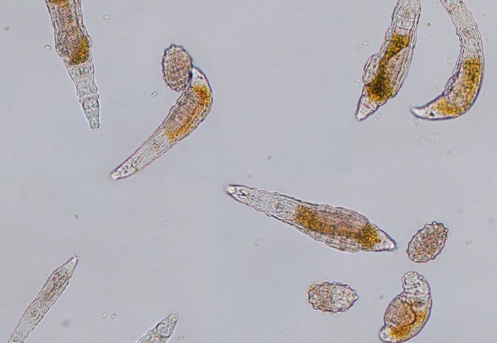 Bdelloid rotifers