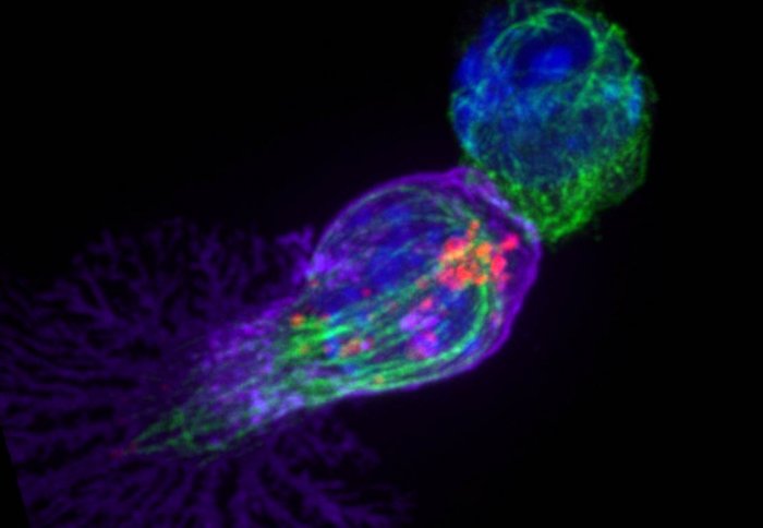A CD8 T cell. Image courtesy of Professor Gillian Griffiths, University of Cambridge.