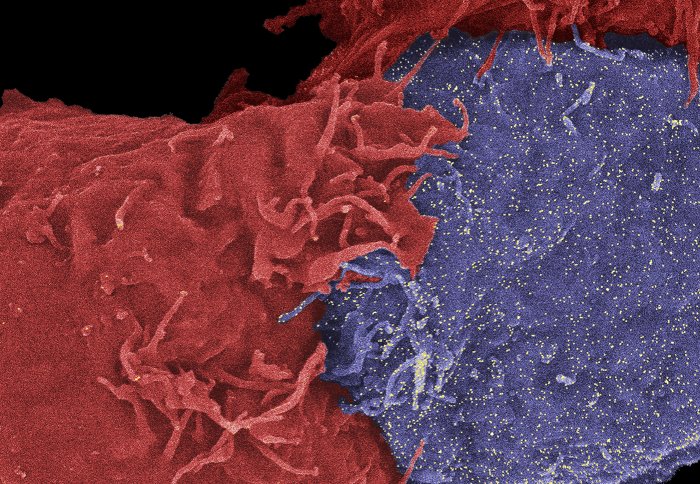 Natural killer cells (red) killing a target cell (blue).