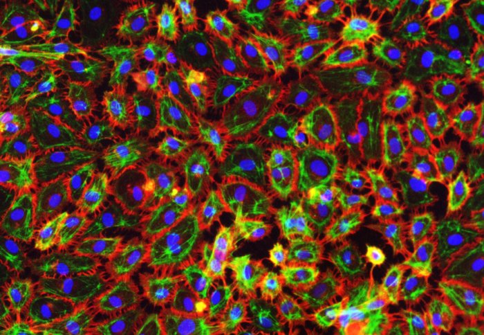 endothelial cells grown from stem cells in the blood